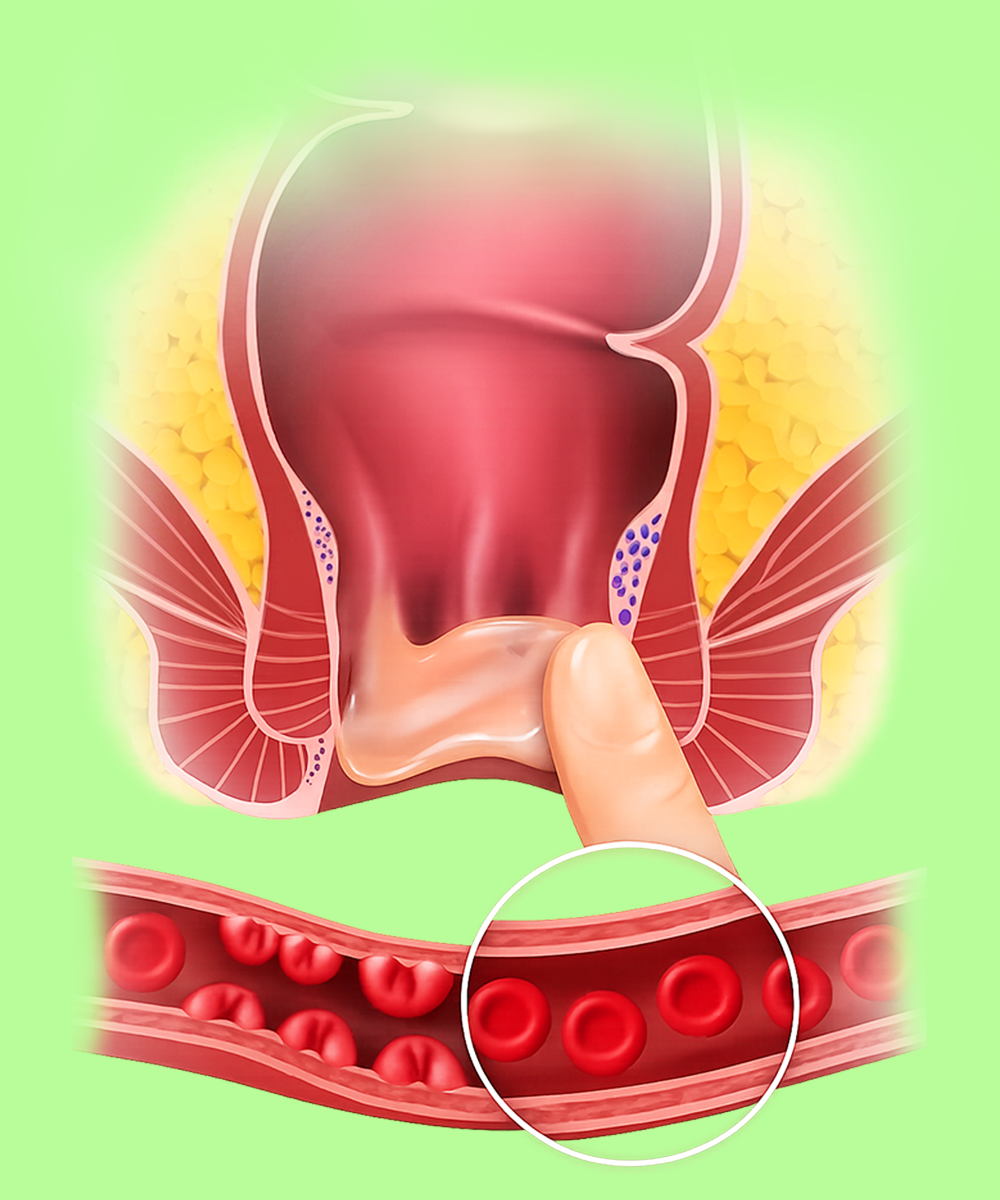 Peach Cream calming visualization