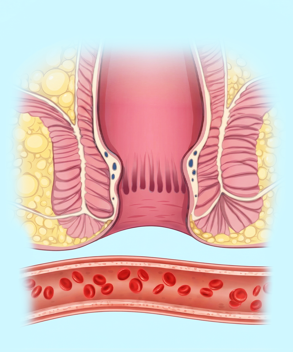 Natural calm transformation